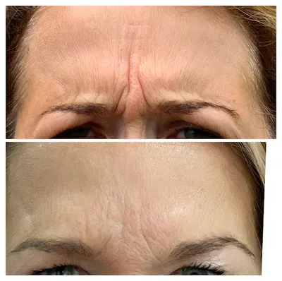 Medycyna Estetyczna Arentewicz.pl Bydgoszcz